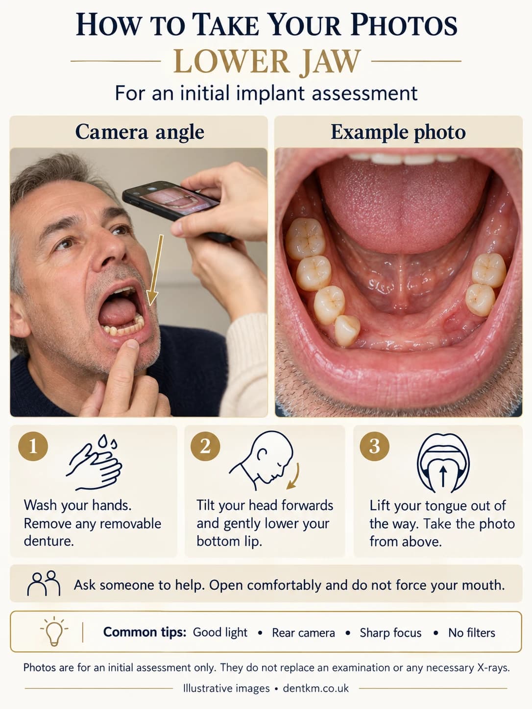 How to photograph your lower jaw: tilt your head forwards, lower your bottom lip, lift your tongue and shoot from above